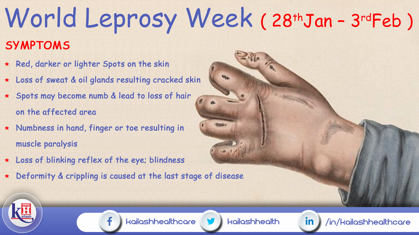 Early diagnosis & treatment can prevent disability from Leprosy