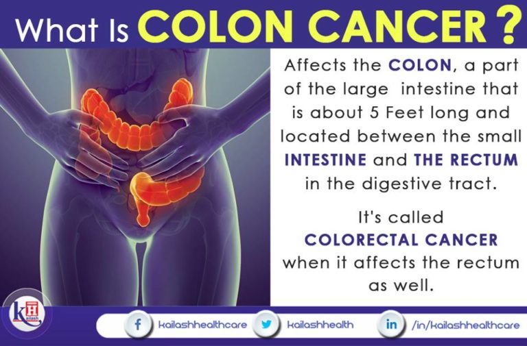 Colorectal cancer may be benign, or noncancerous & can spread to other