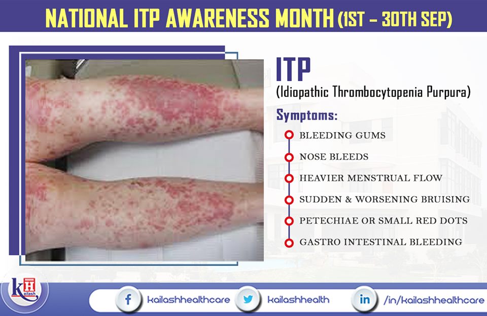 ITP Can Be Threatening If Left Untreated On Time Know About Symptoms 