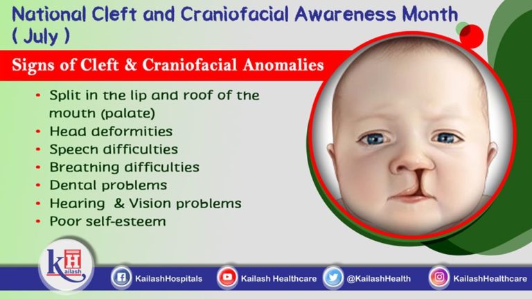 National Cleft And Craniofacial Awareness Month (July)