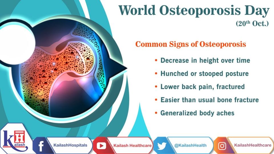 Osteoporosis often considered a “silent bone disease” doesn't show any signs in early stages unless a person has a severe bone fracture or break.