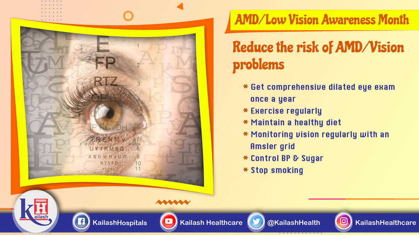 Regular Eye exam & proper care can help lower the risk of vision problems & age- related macular degeneration.