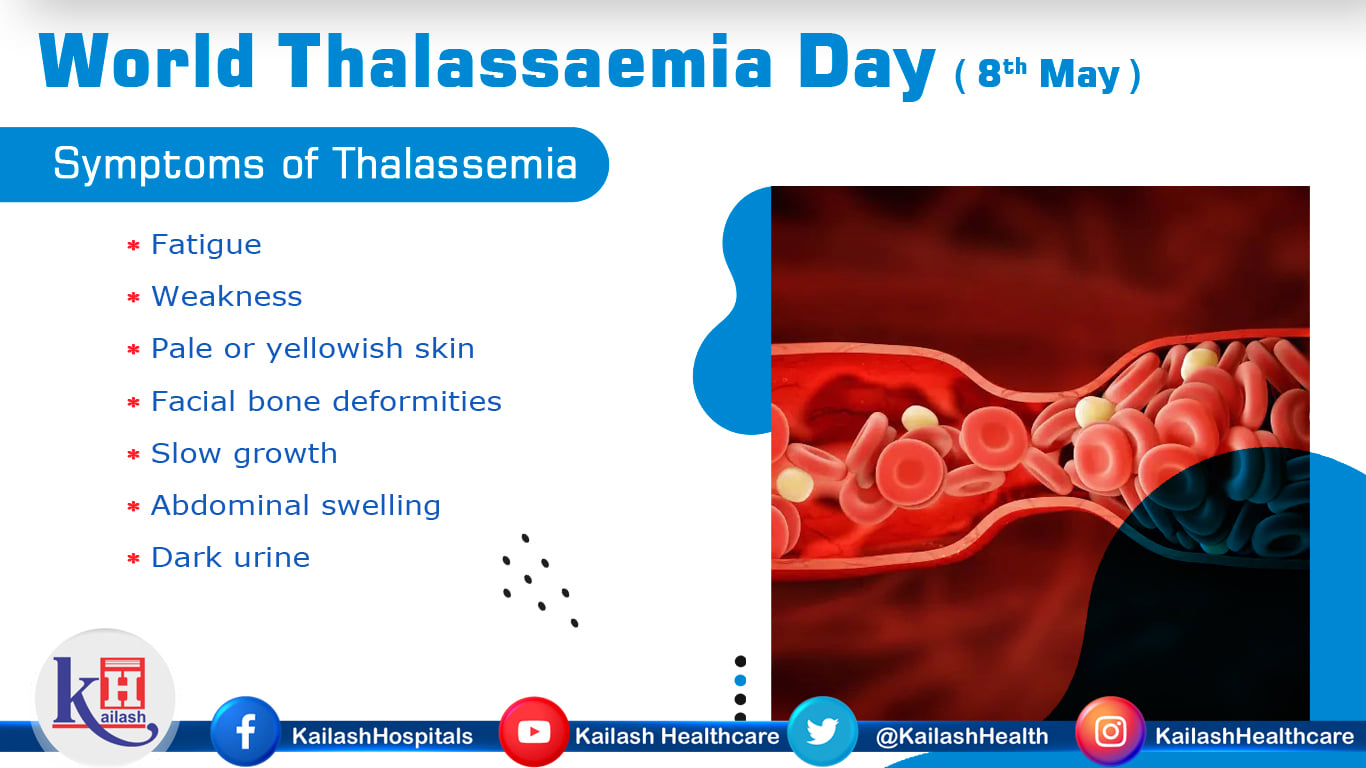 Thalassemia is an inherited blood disorder in which the body makes an abnormal form of hemoglobin which leads to pale skin, bone deformities etc.