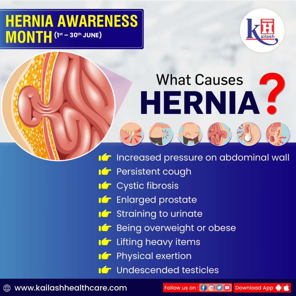 what is hernia disease
