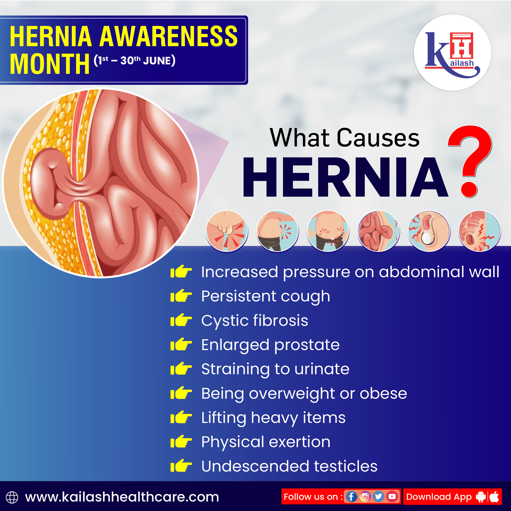 Lumbar Hernia In English At Rodney Hickman Blog