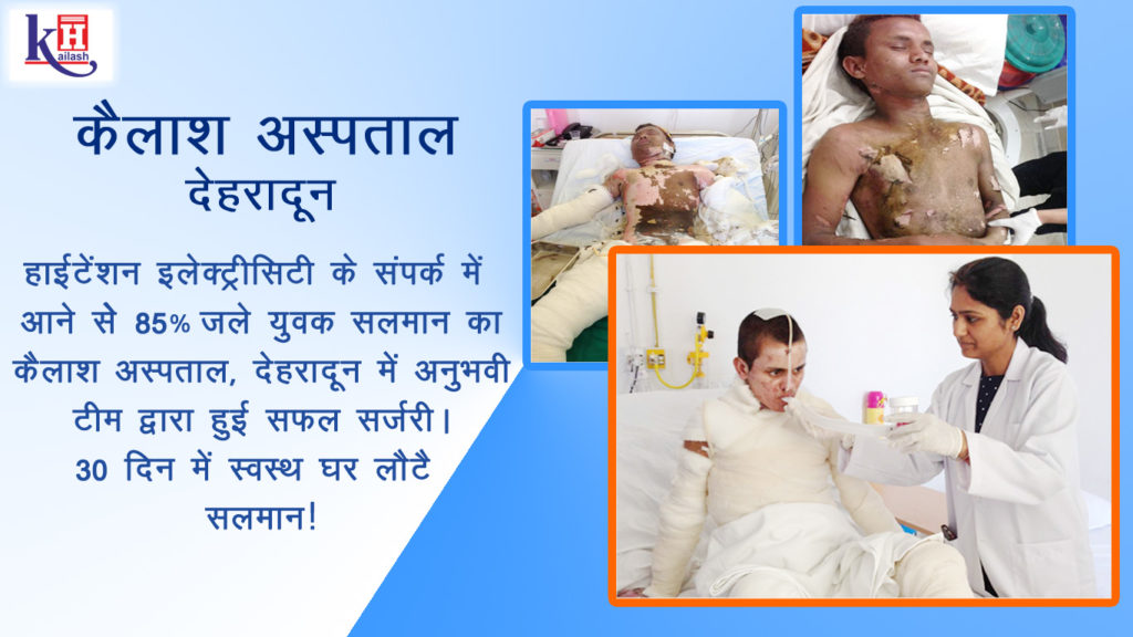 Successful survival journey of 85% Burn Patient