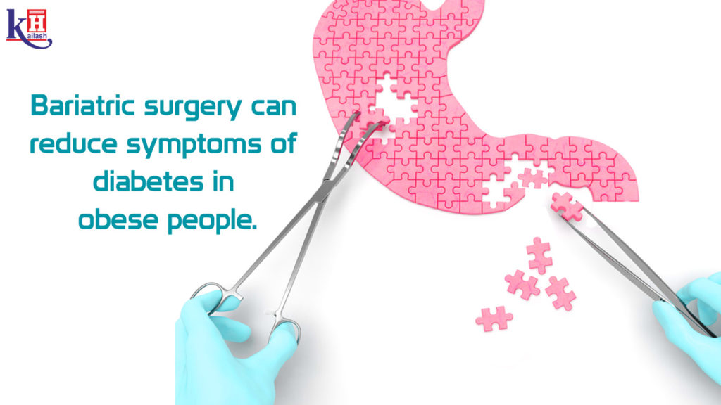 Bariatric surgery
