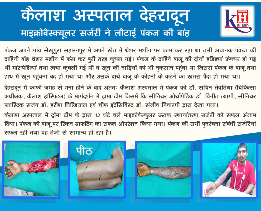 कैलाश अस्पताल देहरादून के माइक्रोवैस्क्यूलर सर्जरी ने लौटाई पंकज की बांह