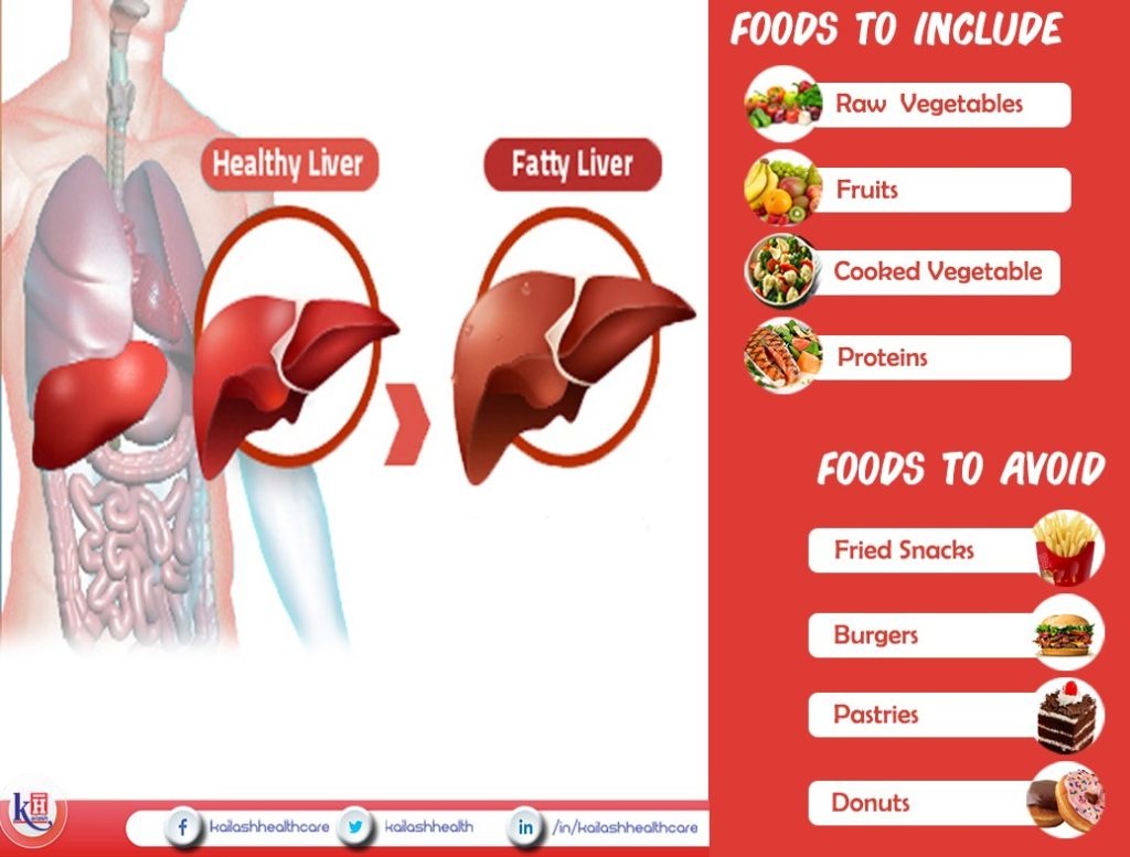 Fatty Liver Diet: Foods to Include & Avoid