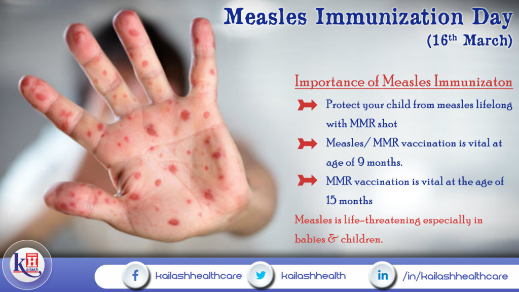 Measles Immunization Day ( 16th March 2018 )
