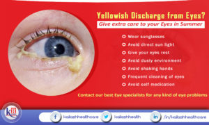 Take extra care for your Eyes this Summer to prevent eye infections. Follow these tips.