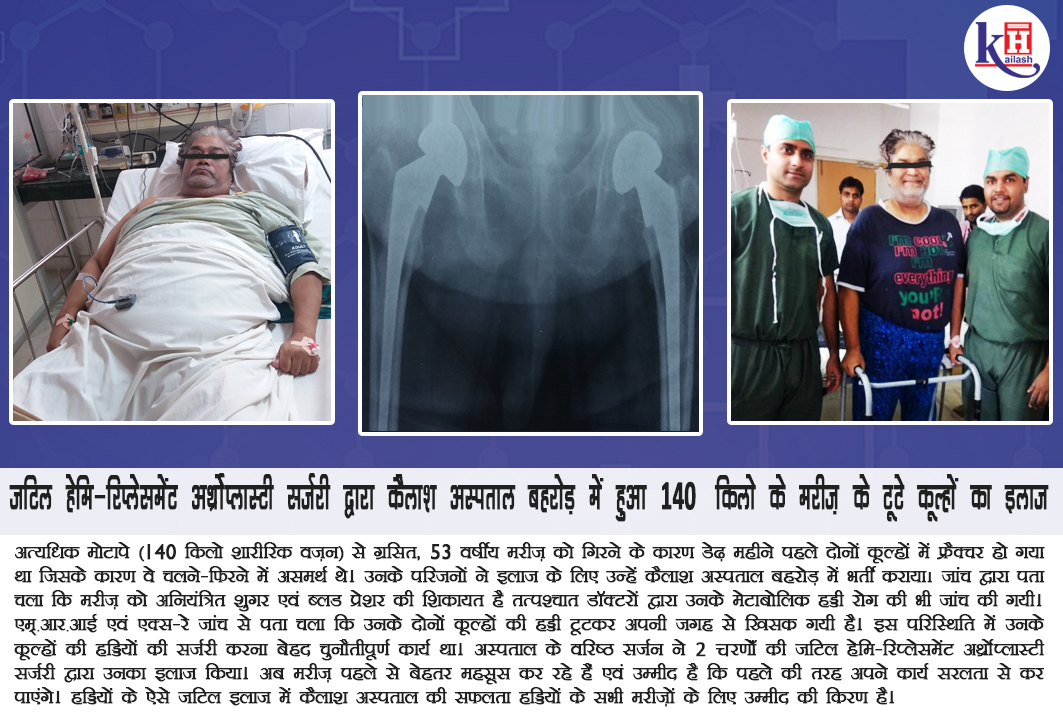 जटिल हेमि-रिप्लेसमेंट अर्थ्रोप्लास्टी सर्जरी द्वारा कैलाश अस्पताल बहरोड़ में हुआ 140 किलो के मरीज़ के टूटे कूल्हों का इलाज