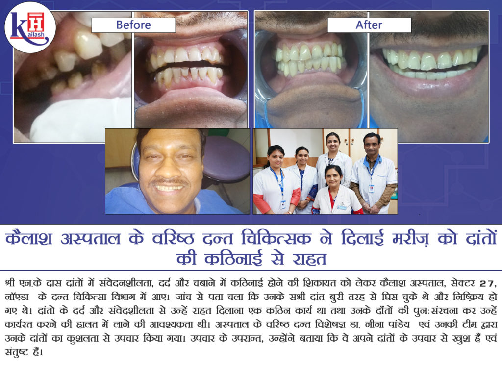 Specialized Dental Treatment by Sr. Dental Expert of Kailash Hospital relieves a patient from Chronic Dental problem