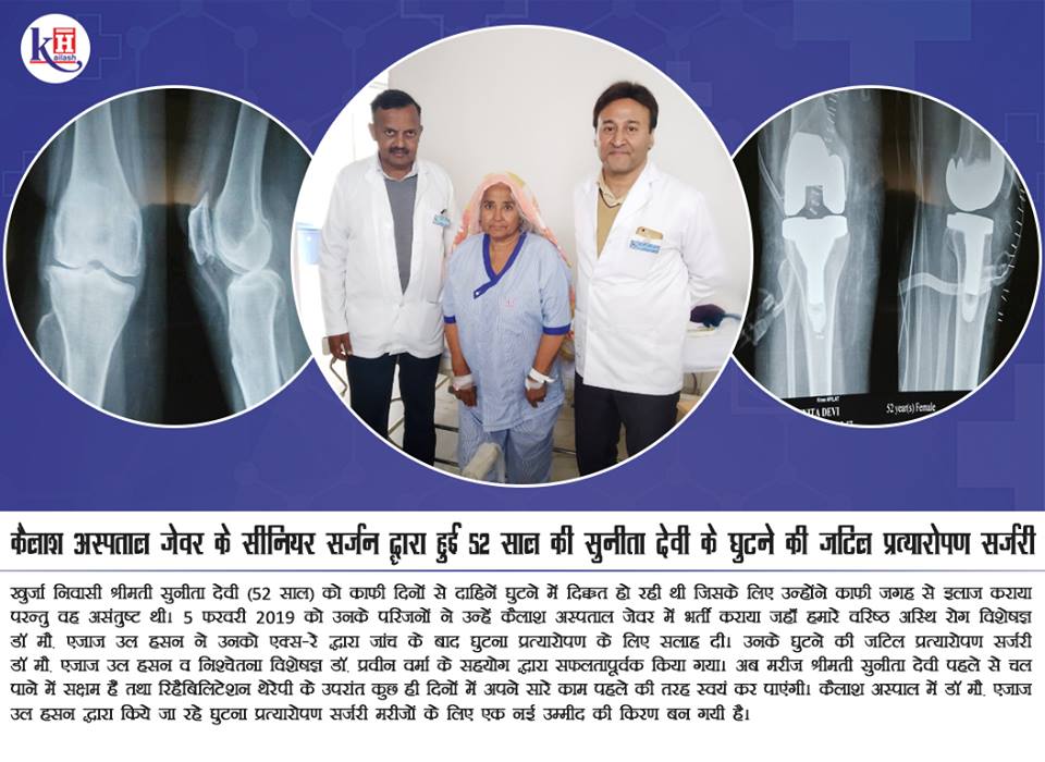 कैलाश अस्पताल के वरिष्ठ हड्डी सर्जन ने किया सुनीता देवी के घुटनों की सफल घुटना प्रत्यारोपण सर्जरी |