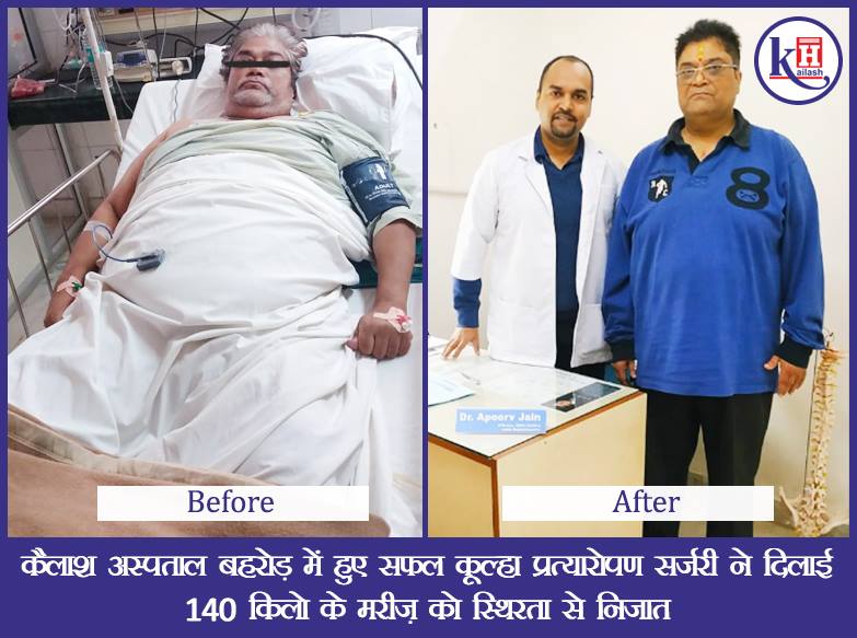 कैलाश अस्पताल बहरोड़ में हुए सफल कुल्हा प्रत्यारोपण सर्जरी ने दिलाई 140 किलो के मरीज़ को स्थिरता से निजात