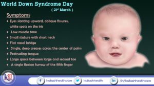 Know about the symptoms of Down Syndrome. Encourage care & support to them.