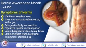 Hernia is an unusual lump in the abdominal area. Know the symptoms of Hernia before it worsens.