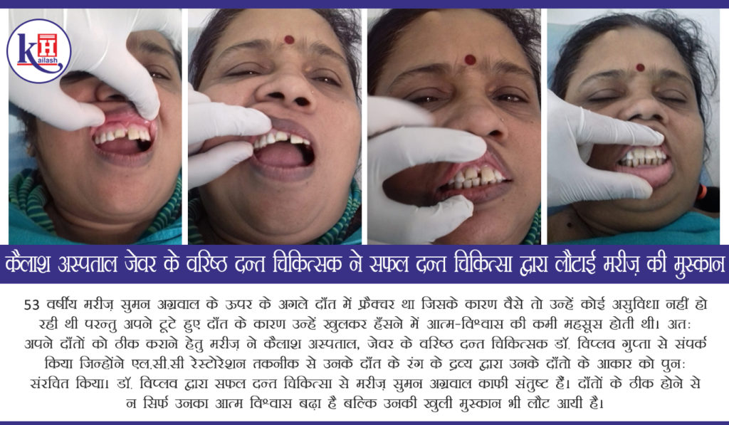 53yr old patient gets back her beautiful Smile after Successful Dental Treatment at Kailash Hospital, Jewar