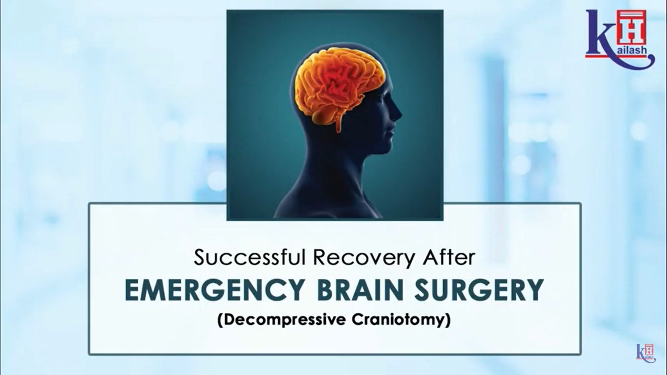 Successful Recovery after Emergency Brain Surgery | Neurosurgeon Dr. Shrikant Sharma KHNI