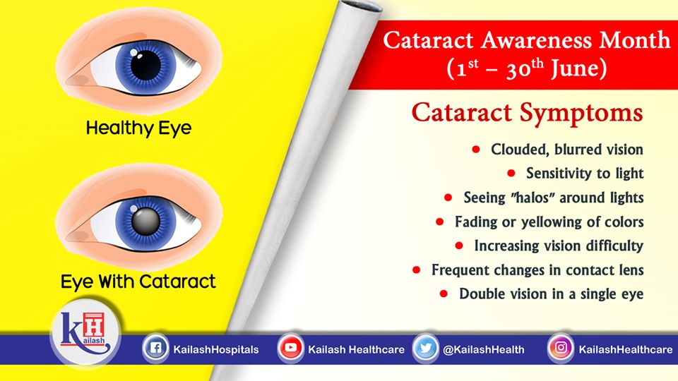 If you are experiencing blurred and clouded vision with double vision, get your eyes checked it may indicate Cataract.