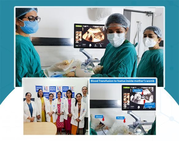 Rare Feat: First-ever ‘Intrauterine Transfusion’ in Gautam Buddha Nagar Successfully performed by our Fetal Medicine Team of Kailash Hospital, Sec-27 Noida.