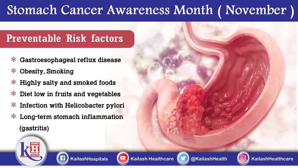Chronic Gastritis or Gastroesophageal Disease can risk you to Stomach Cancer. If these diseases can be controlled, Stomach Cancer can be prevented.