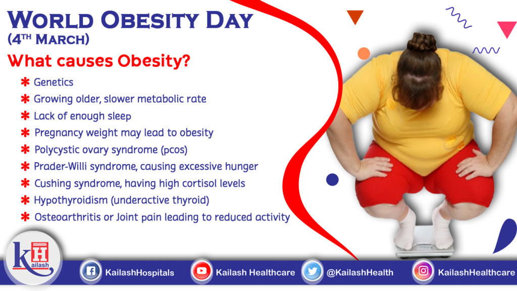 Here's answer to the big question "What causes Obesity?