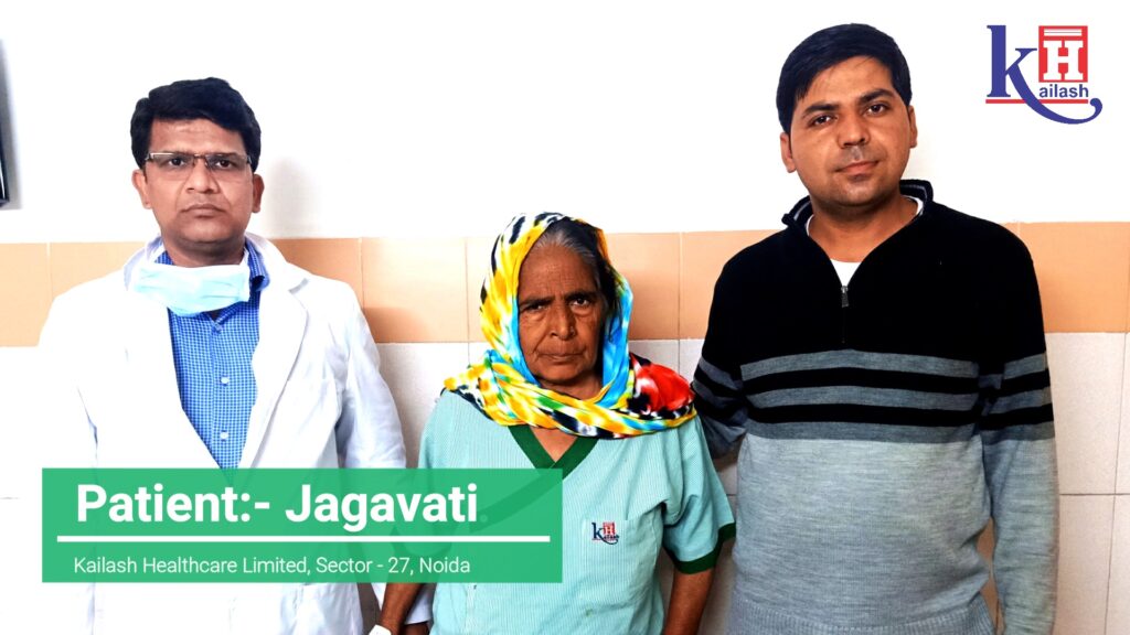 Successful Knee Replacement Surgery of 55 yr old patient | Kailash Hospital Sector- 27 Noida