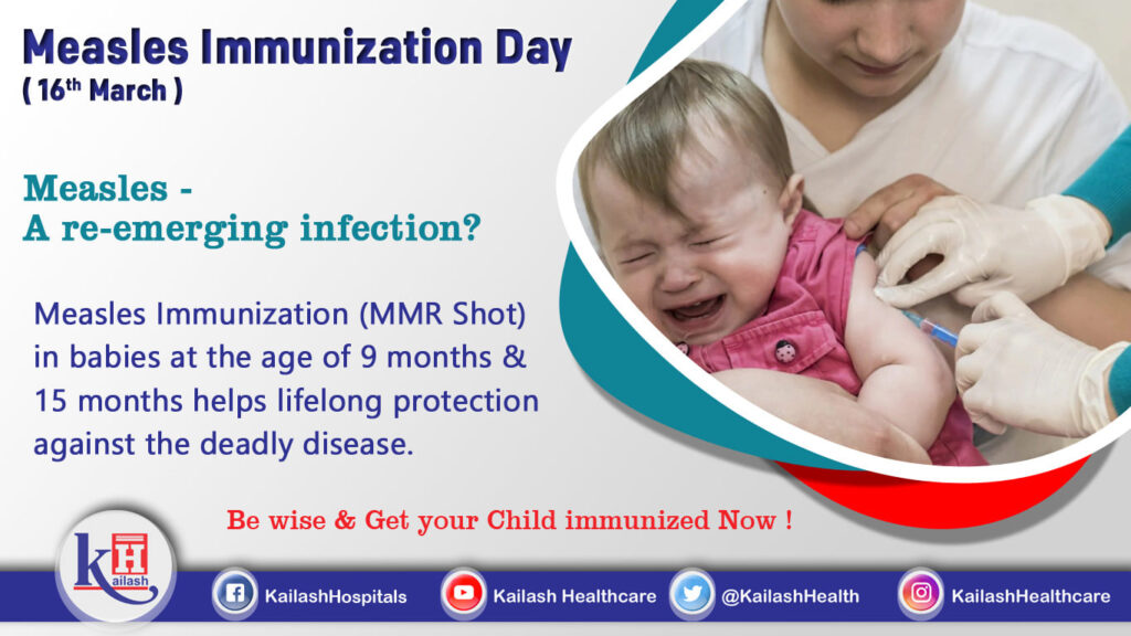 MMR Shot or Measles Vaccination is the best way to prevent Measles Infection in children. Get your Child Vaccinated today