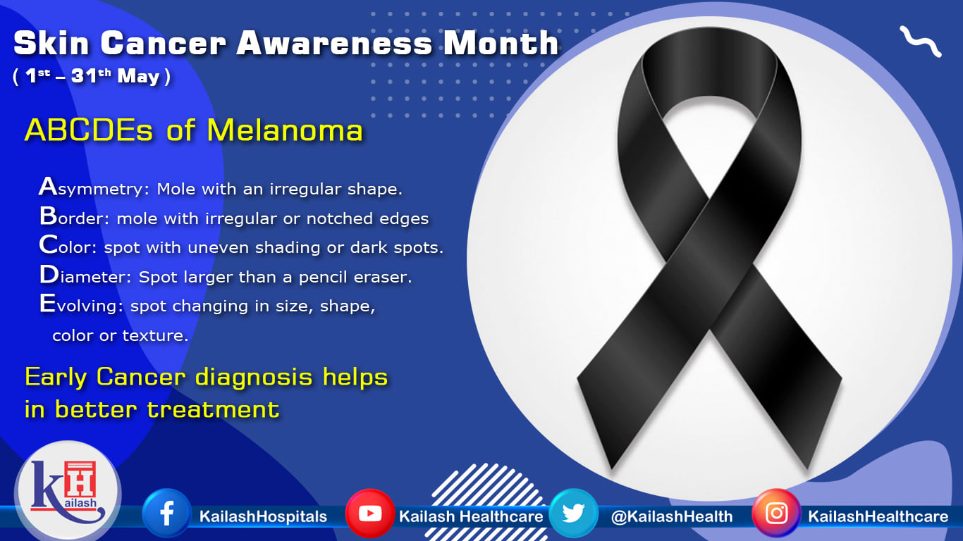 The first sign of melanoma is often a mole that changes size, shape or color. Here are the symptoms.