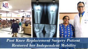 Bilateral Total Knee Replacement of Morbidly Obese patient | Kailash Hospital Sec 27 Noida