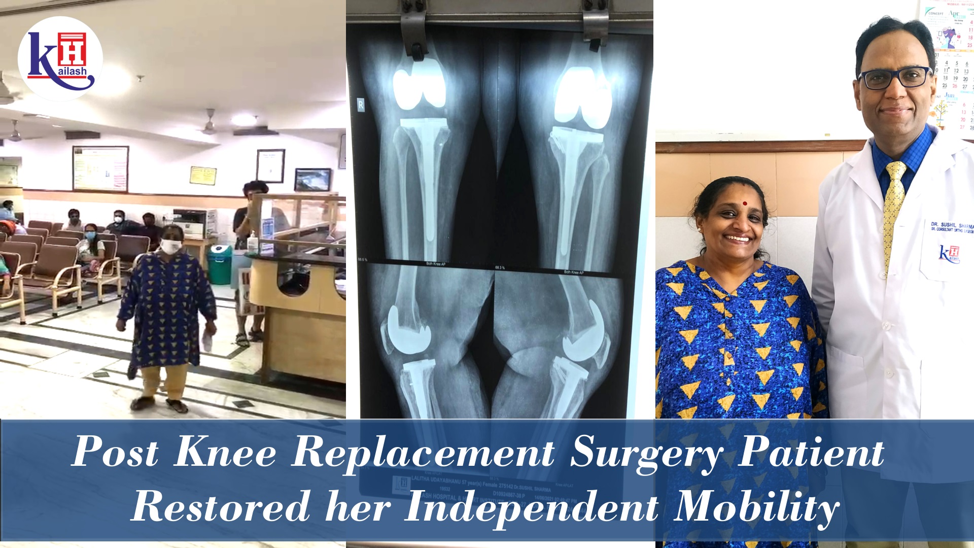 Bilateral Total Knee Replacement of Morbidly Obese patient | Kailash Hospital Sec 27 Noida
