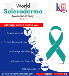 Currently, there is hardly any cure for scleroderma while it can be managed well through these lifestyle tips.
