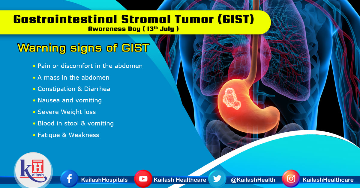 GIST is a type of tumor that occurs in the gastrointestinal tract, most commonly in the stomach or small intestine.