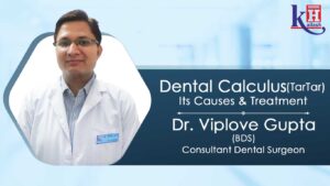 Dental Calculus: Causes, Prevention & Treatment | Kailash Hospital Jewar