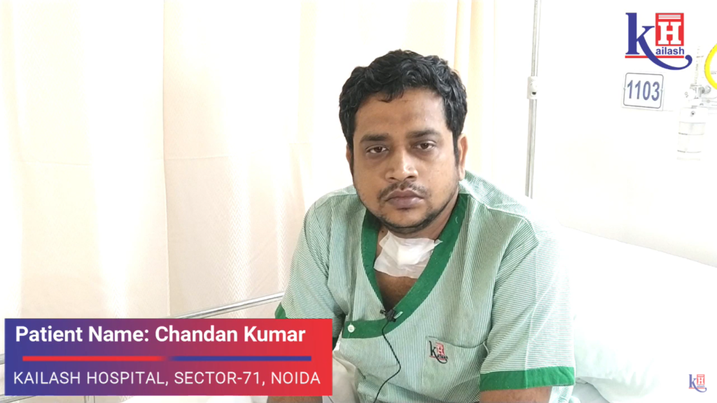 Timely Diagnosis of Sleep Apnea gave freedom from CPAP Machine | Kailash Hospital, Sector 71, Noida