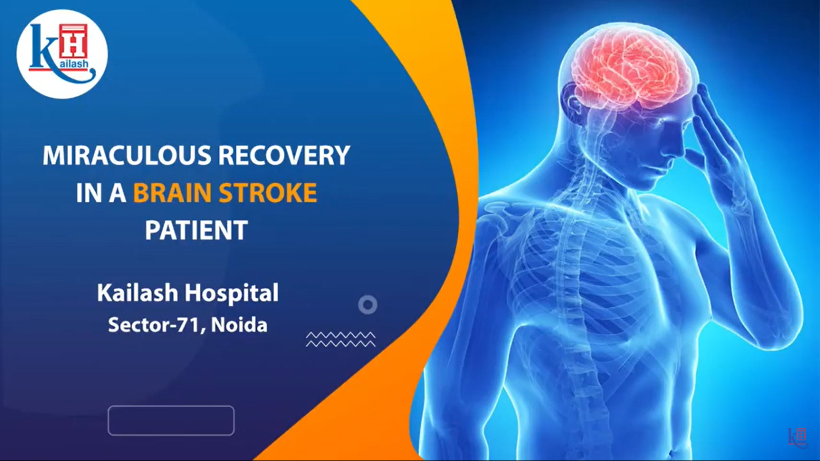 Miraculous recovery in a Brain Stroke patient | Kailash Hospital, Sector-71, Noida