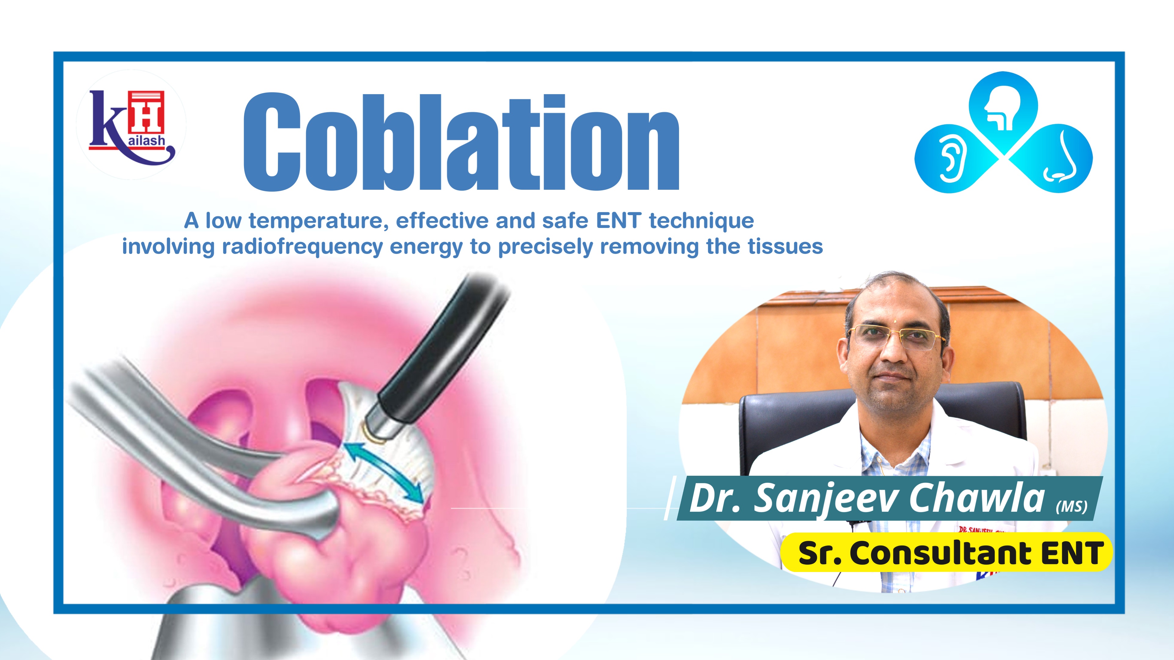 ENT Coblation: Safe Treatment of Adenotonsilectomy | Kailash Hospital Sector 27 Noida